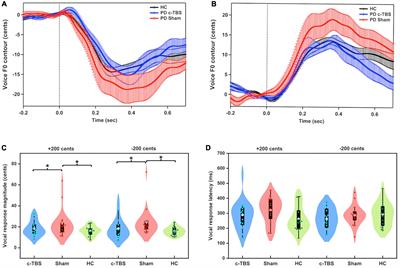 Continuous theta burst stimulation over left supplementary motor area facilitates auditory-vocal integration in individuals with Parkinson’s disease